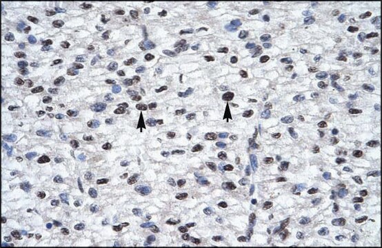 抗-GLI2 IgG fraction of antiserum