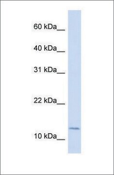 Anti-CRABP2 antibody produced in rabbit affinity isolated antibody