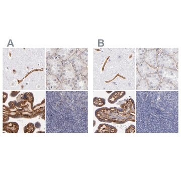 Anti-LAMC1 antibody produced in rabbit Ab1, Prestige Antibodies&#174; Powered by Atlas Antibodies, affinity isolated antibody, buffered aqueous glycerol solution