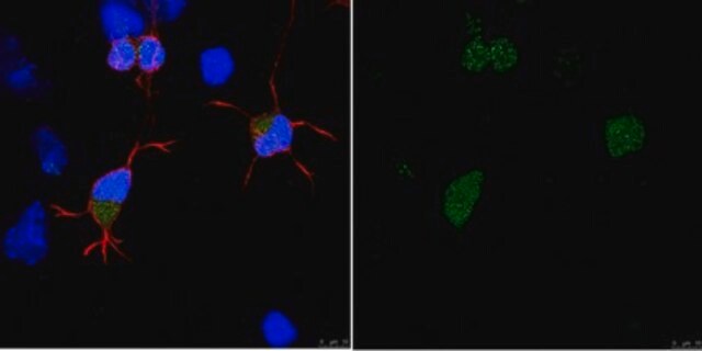 Anti-APP Antibody, clone 2B3 clone 2B3, from mouse