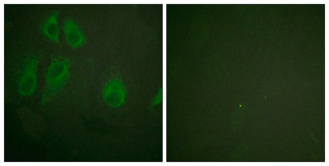 Anti-IL-2R &#945; antibody produced in rabbit affinity isolated antibody