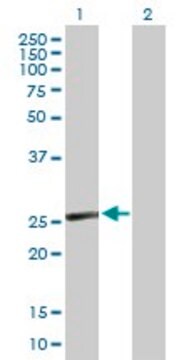 Anti-CD8B antibody produced in mouse purified immunoglobulin, buffered aqueous solution