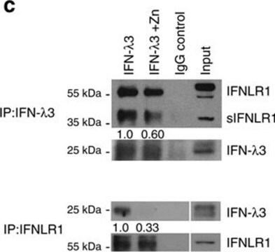 抗IFNLR1 ウサギ宿主抗体 Prestige Antibodies&#174; Powered by Atlas Antibodies, affinity isolated antibody, buffered aqueous glycerol solution