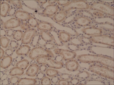 Anti-p120-catenin antibody, Rabbit monoclonal recombinant, expressed in HEK 293 cells, clone RM353, purified immunoglobulin