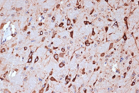 Anti-PRKRA/PACT Antibody, clone 2W2E10, Rabbit Monoclonal