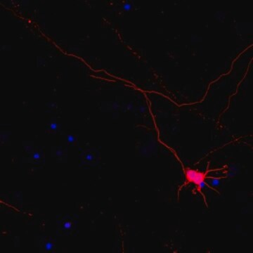 Neuro-Chrom Pan Neuronal Marker Antibody-Rabbit, koniugat Cy3 Neuro-Chrom, from rabbit