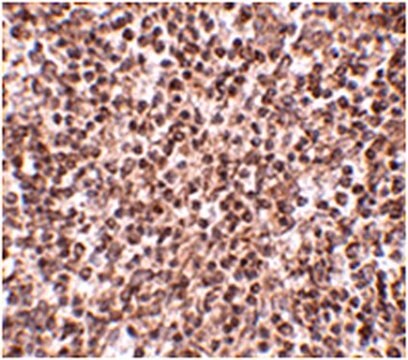 Anti-TREX1 Antibody from rabbit, purified by affinity chromatography