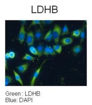 Anti-LDHB affinity isolated antibody