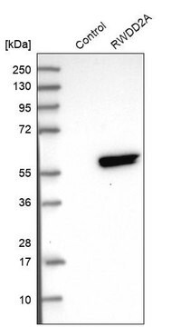 Anti-RWDD2A antibody produced in rabbit Prestige Antibodies&#174; Powered by Atlas Antibodies, affinity isolated antibody, buffered aqueous glycerol solution, ab3