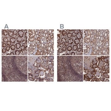 Anti-PLA2G15 antibody produced in rabbit affinity isolated antibody, buffered aqueous glycerol solution