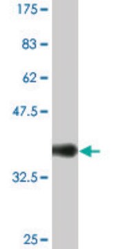 Monoclonal Anti-SNCG, (C-terminal) antibody produced in mouse clone 2C3, ascites fluid