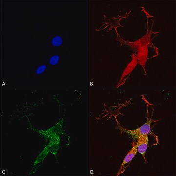 Monoclonal Anti-Copper Transporting Atpase 2 - Hrp antibody produced in mouse clone S62-29, purified immunoglobulin