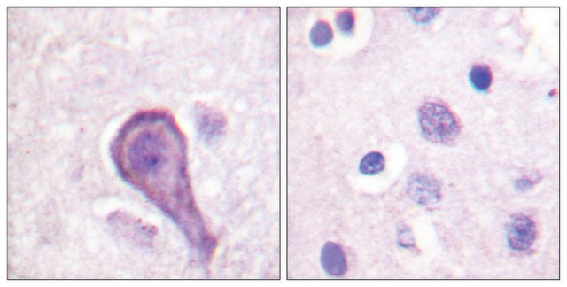 Anti-Rhodopsin antibody produced in rabbit affinity isolated antibody