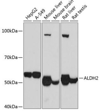 Anti-ALDH2 antibody produced in rabbit