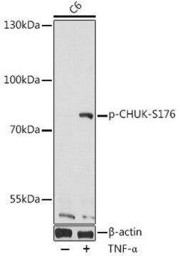 Anti-Phospho-CHUK-S176 antibody produced in rabbit