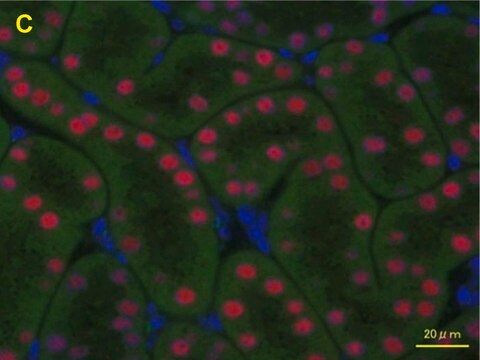 抗 HNF1B 兔抗 Prestige Antibodies&#174; Powered by Atlas Antibodies, affinity isolated antibody, buffered aqueous glycerol solution