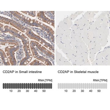 Anti-CD2AP antibody produced in rabbit Ab1, Prestige Antibodies&#174; Powered by Atlas Antibodies, affinity isolated antibody, buffered aqueous glycerol solution