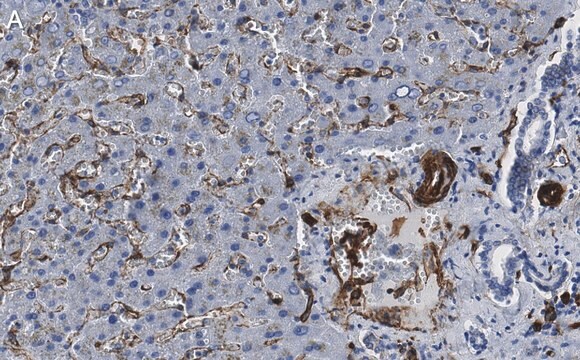 Anti-Caveolin-1 Antibody, clone 1D10 ZooMAb&#174; Rabbit Monoclonal recombinant, expressed in HEK 293 cells