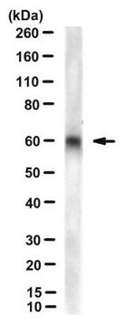 Anticorpo anti-VANGL2, clone 2G4 clone 2G4, from rat