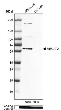 Anti-MBOAT2 antibody produced in rabbit Prestige Antibodies&#174; Powered by Atlas Antibodies, affinity isolated antibody, buffered aqueous glycerol solution