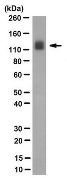 Anti-HSV1-ICP8 Antibody, clone 10A3 clone 10A3, from mouse