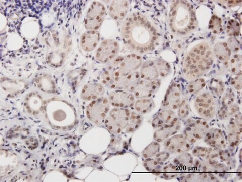 Anti-POLB antibody produced in mouse IgG fraction of antiserum, buffered aqueous solution