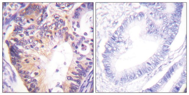 Anti-PAK1 antibody produced in rabbit affinity isolated antibody