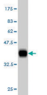 ANTI-KIT antibody produced in mouse clone 2C3, purified immunoglobulin, buffered aqueous solution