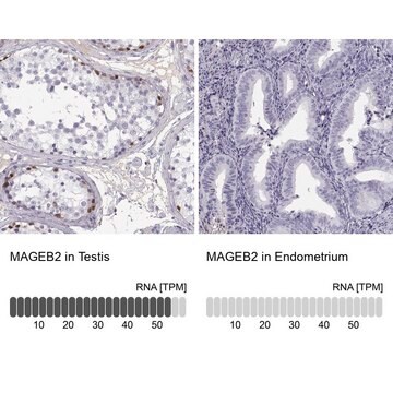 Anti-MAGEB2 Prestige Antibodies&#174; Powered by Atlas Antibodies, affinity isolated antibody