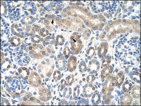 Anti-CAV1 antibody produced in rabbit purified antibody, Protein A purified