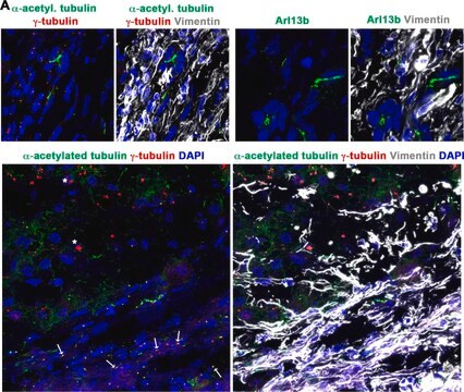 抗-&#947;-微管蛋白 affinity isolated antibody, buffered aqueous solution