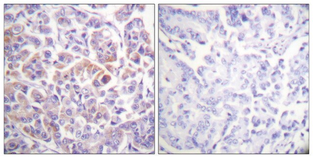 Anti-C-RAF antibody produced in rabbit affinity isolated antibody