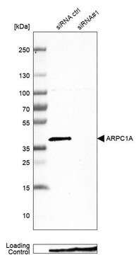 Anti-ARPC1A antibody produced in rabbit Prestige Antibodies&#174; Powered by Atlas Antibodies, affinity isolated antibody, buffered aqueous glycerol solution