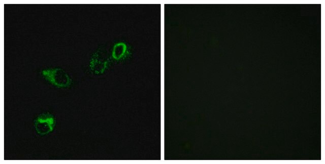 Anti-CCRL1 antibody produced in rabbit affinity isolated antibody