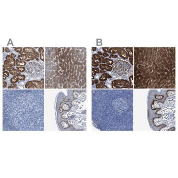 抗ASS1 ウサギ宿主抗体 Prestige Antibodies&#174; Powered by Atlas Antibodies, affinity isolated antibody, buffered aqueous glycerol solution