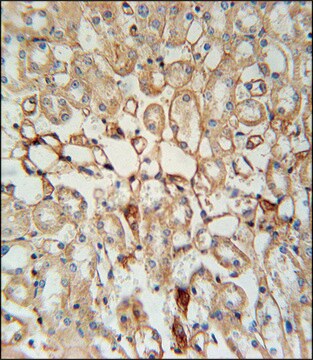 ANTI-KCNV1 (N-TERM) antibody produced in rabbit IgG fraction of antiserum, buffered aqueous solution