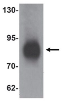 Anti-LRRFIP1 Antibody from rabbit, purified by affinity chromatography