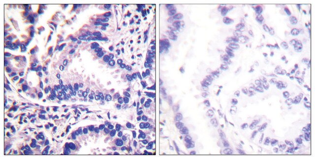 Anti-Synuclein &#947; antibody produced in rabbit affinity isolated antibody