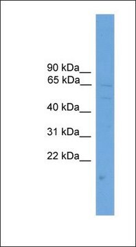 Anti-SOAT1 antibody produced in rabbit affinity isolated antibody