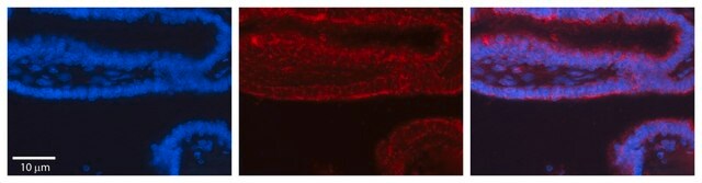 Anti-TRIM32 antibody produced in rabbit affinity isolated antibody