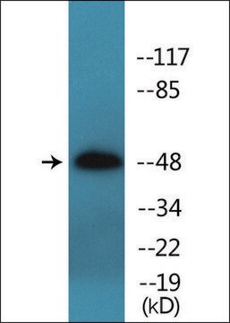 Anti-phospho-IL-13R &#945;1 (pTyr405) antibody produced in rabbit affinity isolated antibody