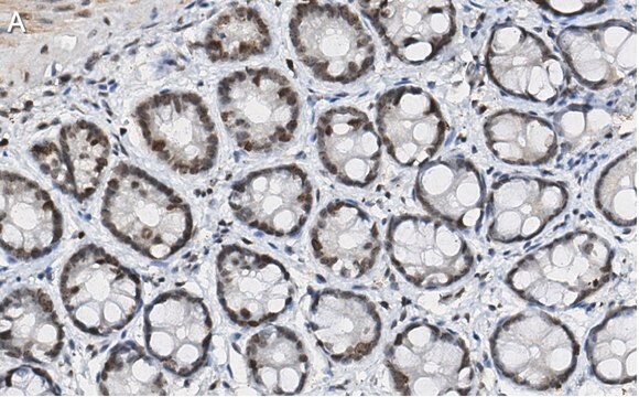 抗p-ヒストンH2A（Ser139）抗体 クローンJBW301 ZooMAb&#174;マウス・モノクローナル recombinant, expressed in HEK 293 cells