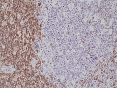 Anti-CD5 antibody, Rabbit monoclonal recombinant, expressed in HEK 293 cells, clone RM314, purified immunoglobulin