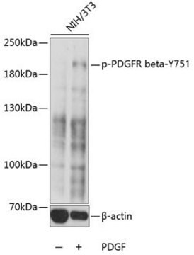 Anti-Phospho-PDGFR beta-Y751 antibody produced in rabbit