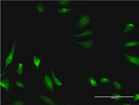 Monoclonal Anti-CBS antibody produced in mouse clone 3D10, purified immunoglobulin, buffered aqueous solution