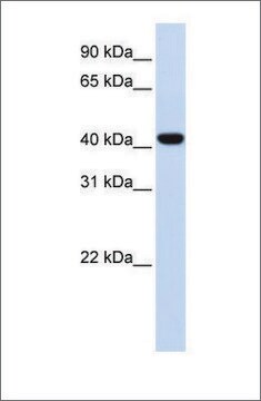 抗FOXD1抗体 ウサギ宿主抗体 affinity isolated antibody