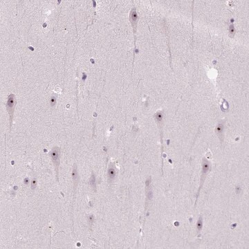 Anti-UTP4 antibody produced in rabbit Prestige Antibodies&#174; Powered by Atlas Antibodies, affinity isolated antibody, buffered aqueous glycerol solution