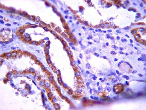 Anti-Protein patched homolog 1 Antibody from rabbit, purified by affinity chromatography