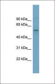 Anti-SLC22A15 antibody produced in rabbit affinity isolated antibody