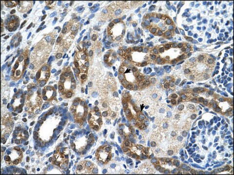 Anti-PKLR antibody produced in rabbit IgG fraction of antiserum